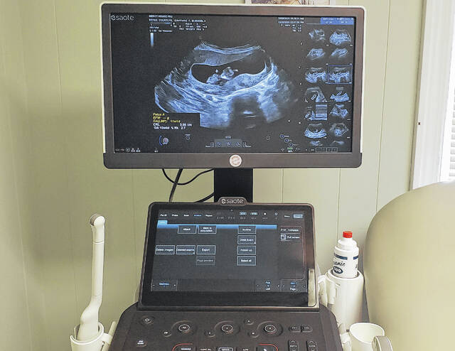 Mercy House unveils ultrasound machine